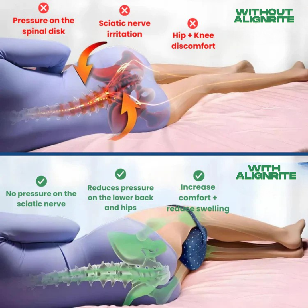 AlignRite™ Orthopedic Leg Pillow