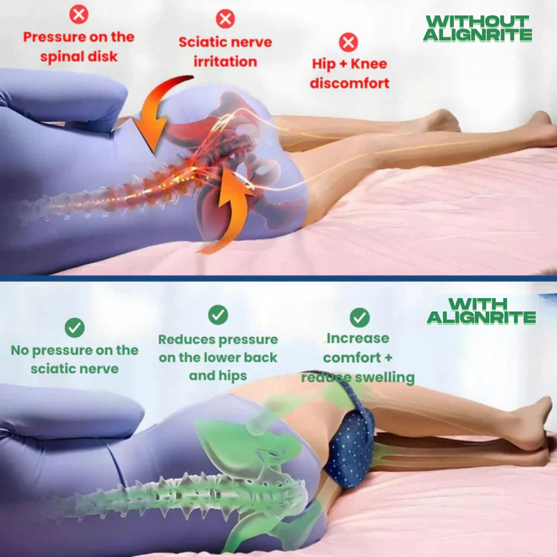AlignRite™ Orthopedic Leg Pillow