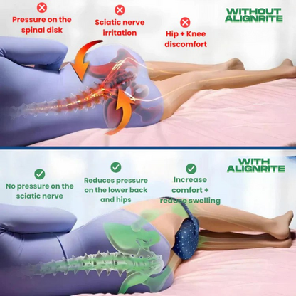 AlignRite™ Orthopedic Leg Pillow