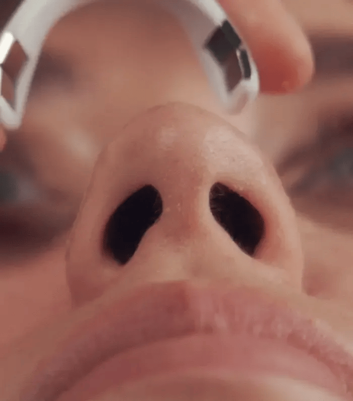 BreatheEasy Magnetic Nasal Strip Kit